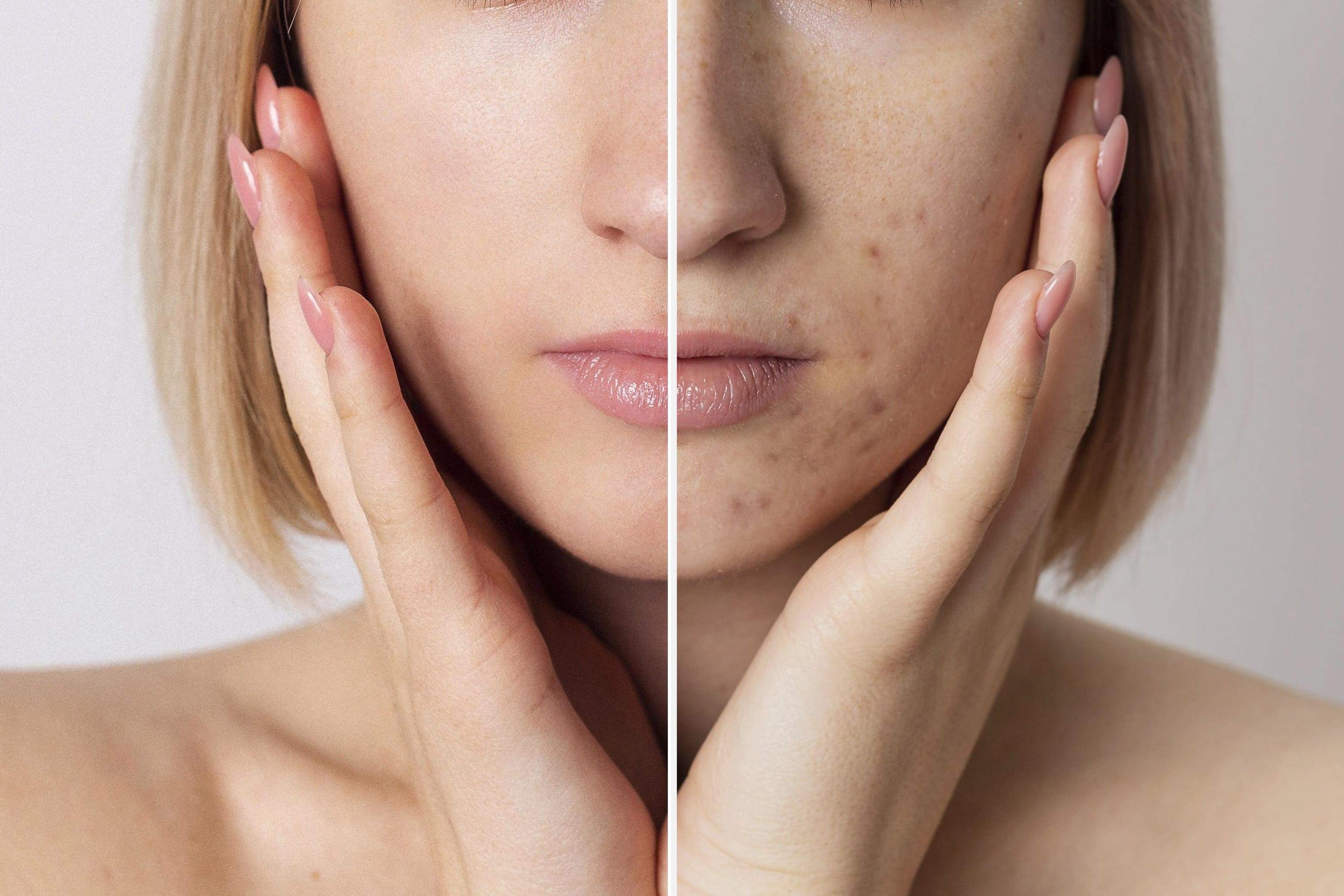 before-after-portrait-woman-retouched-COMPRESSED - Waterfix™